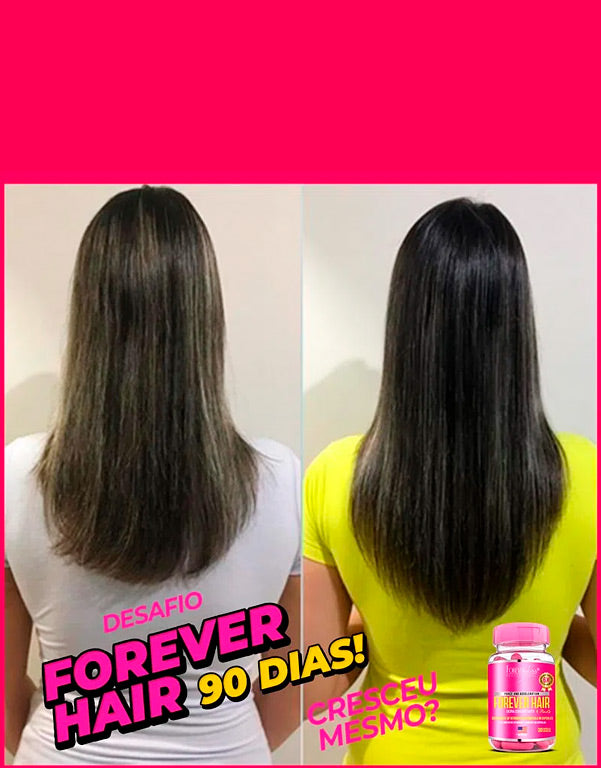 Forever Liss Forever Tratamento 3 Meses Crescimento Capilar - www.tpmdeofertas.com.br